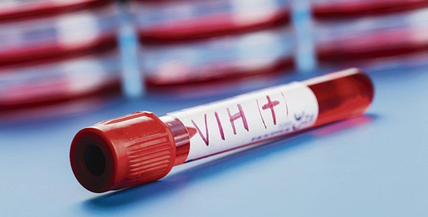 Muestra de laboratorio contagiada con VIH.