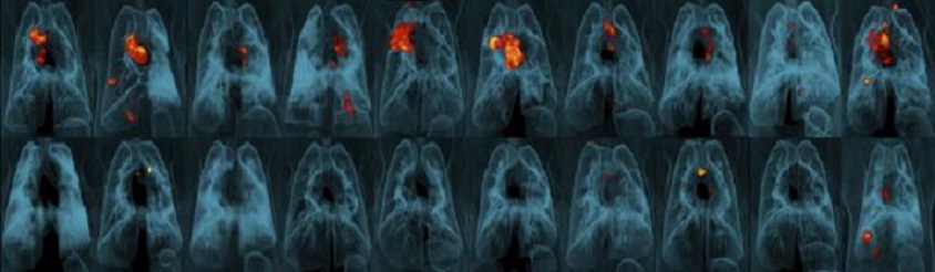 Placa con imágenes pulmonares 20 monos que fueron expuestos a la bacteria de la tuberculosis tras haber recibido una vacuna de distintas formas. (JoAnne Flynn, Alexander White y Pauline Maiello/Pitt Mario Roederer/NIAID vía AP)