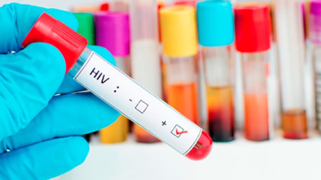 Imagen de una prueba de sangre dando positivo VIH. (Foto: externa)