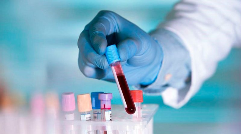 Estudio determina pacientes tipo A de sangre más afectados por efectos coronavirus.