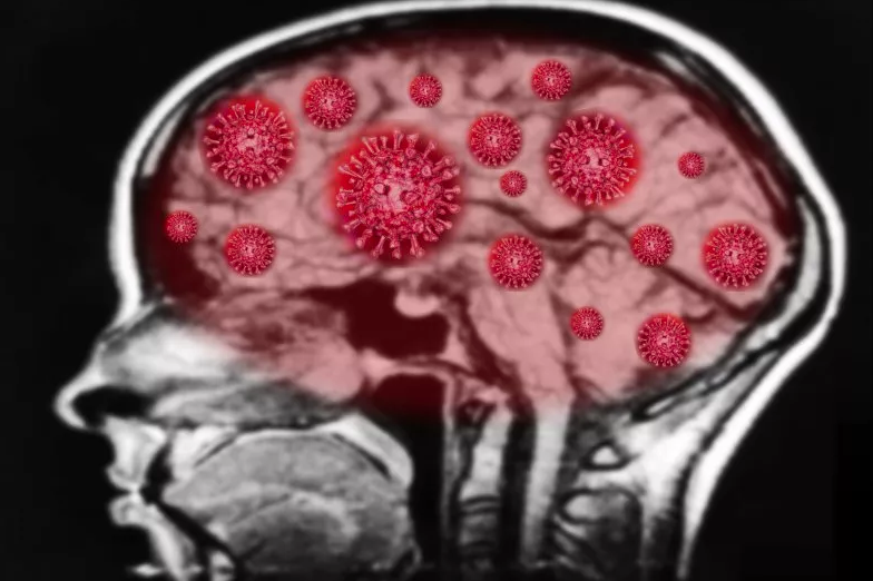 El coronavirus podría hacer que anticuerpos ataquen el cerebro.
