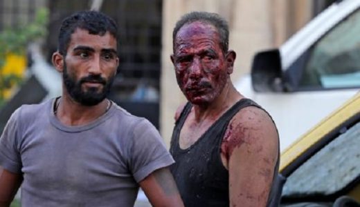 Un hombre con el rostro ensangrentado tras la explosión en Beirut. (Fuente: AFP)