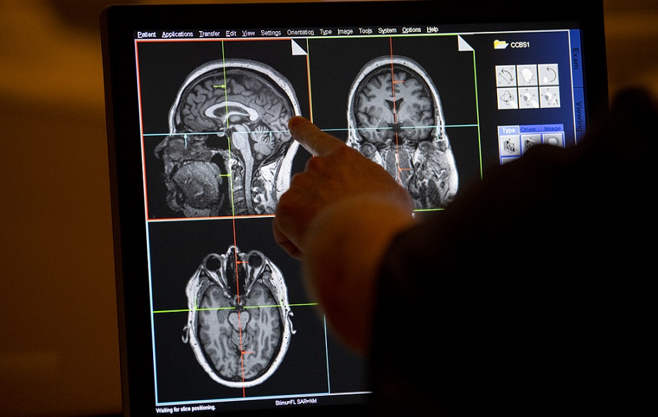 Médicos evalúan estudio cerebral.
